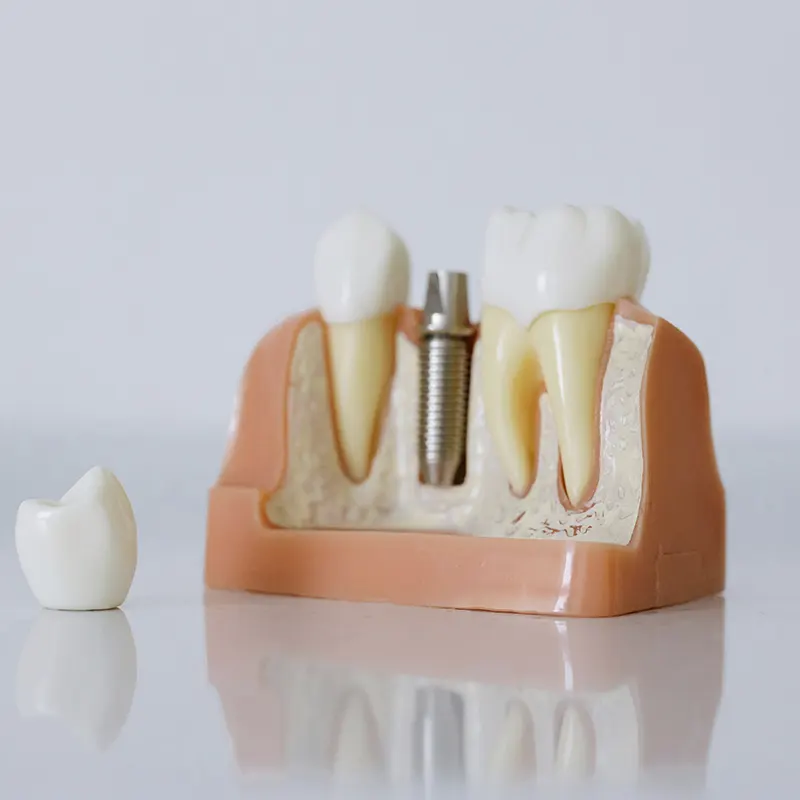  Clínica Dental Benadent Implantología Dental